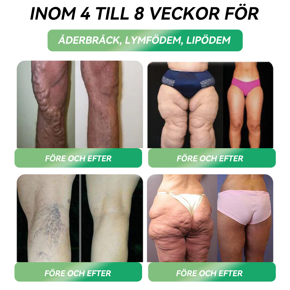 Officiell butik | 𝐋𝑬𝘙𝐶𝘌𝘼® 𝐆𝐋𝐏-𝟏 SIX-IN-ONE Hälsolösning Oral Vätska 🌈🌈 (En dos varje dag – synliga resultat på bara 7 dagar) ⚡ För fetma, hjärt-kärlhälsa, diabetes, sömnapné, ledproblem och mer