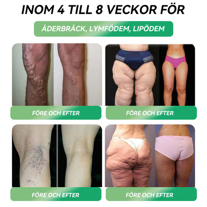 Officiell butik | 𝐋𝑬𝘙𝐶𝘌𝘼® 𝐆𝐋𝐏-𝟏 SIX-IN-ONE Hälsolösning Oral Vätska 🌈🌈 (En dos varje dag – synliga resultat på bara 7 dagar) ⚡ För fetma, hjärt-kärlhälsa, diabetes, sömnapné, ledproblem och mer