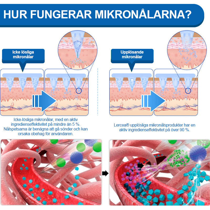 【Sista dagen av kampanj – 60% RABATT🌟】🏆🏆𝐋𝑬𝘙𝐶𝘌𝘼® SMGT-GLP-1 Tirzepatid & Kollagen Nano-Mikronål Viktminskningsplåster丨Bekämpa fetma, slapp hud, högt blodtryck, diabetes, fettlever, ledvärk, hjärndimma med mera